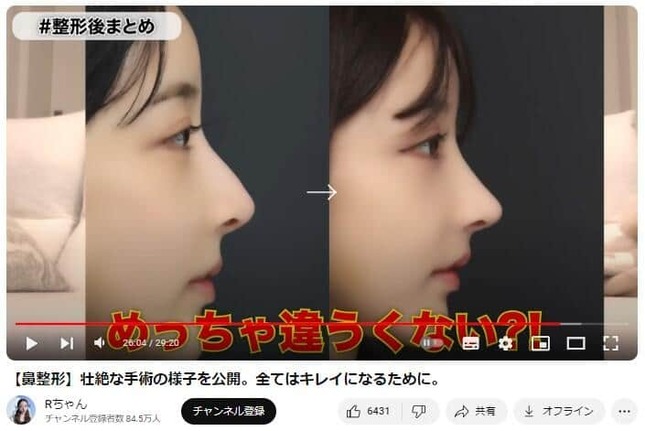 Rちゃんの鼻ピノキオに関する世間の見解